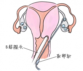 幼儿学画画，长春捐卵宝宝学画画，学画画的好处，如何学画画