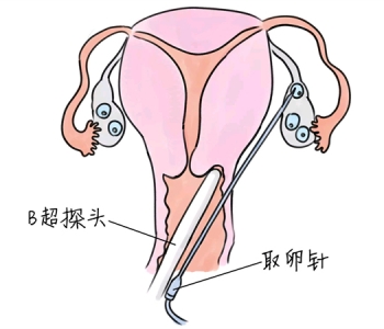 幼儿学画画，长春捐卵宝宝学画画，学画画的好处，如何学画画